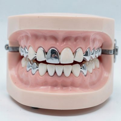 a set of braces on a dental model